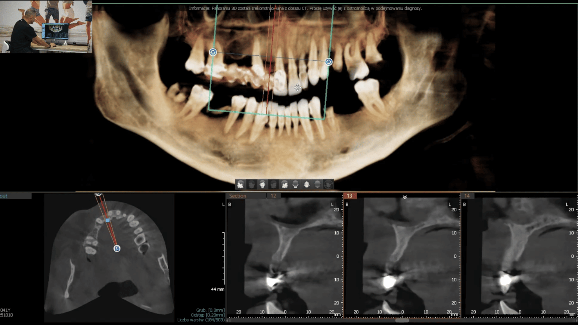 Planowanie 3D: analiza tomografii CBCT