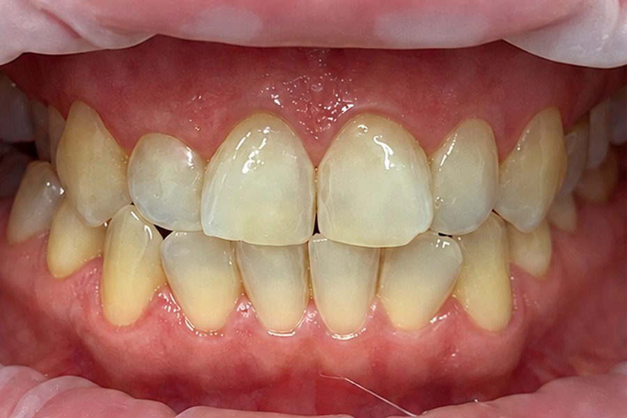 Przypadek kliniczny: stan przed leczeniem